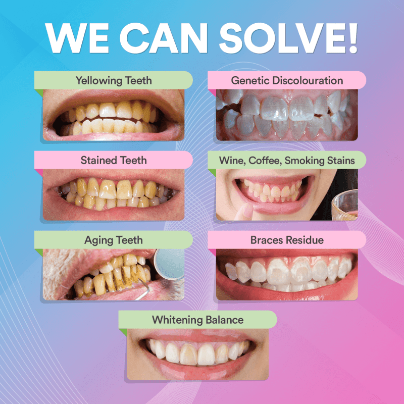 10TeethWhiteningPowderInfographics WeCanSolve 279df24c 790f 4c36 be68 de5f0cf8c3e7