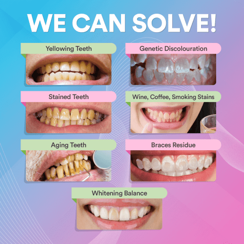 10TeethWhiteningPowderInfographics WeCanSolve ee57c6e4 f9be 4b83 8297 e884a5fd3821